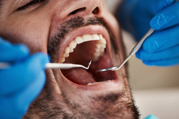 Best Tooth Pain Emergency Relief  in Minneapolis, KS