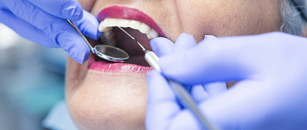 Best Chipped Tooth Repair Near Me  in Minneapolis, KS